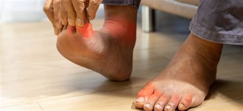 Numbness In Feet And Hands Causes And Treatments Neurvasia
