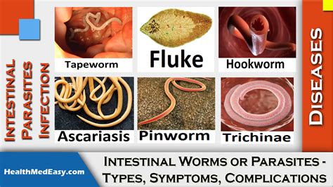 Worms Intestinal Symptoms Types Complications Health Medicine