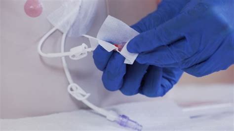 Central Venous Access Devices Made Incredibly Easy Lpn