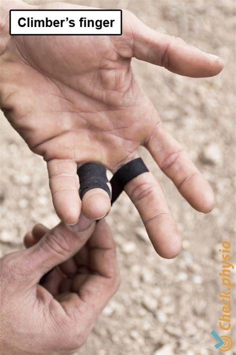 Climber S Finger Physio Check