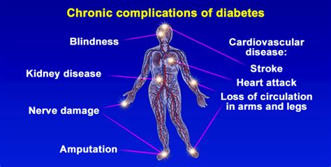 Diabetes Complications Pt 4 Marcos Otero Conexión