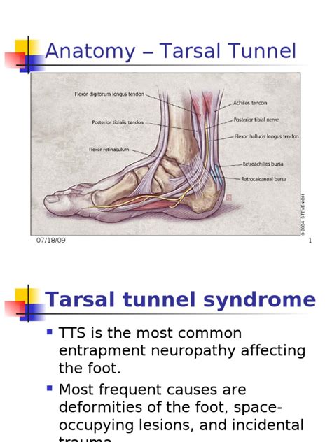 Tarsal Tunnel Syndrome Pdf