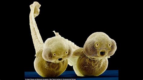 Amazing Deep Sea Microscopic Alien Entities ~ Beautiful