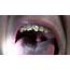 Ridiculously Long Uvula High Def  YouTube