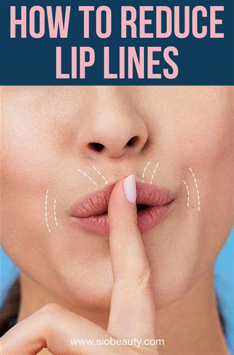 How To Get Rid Of Smokers Lines Easy Steps For Smooth Lips