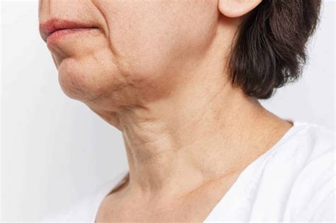 Sagging Neck Best Treatment To Treat It Dr Anthony Bared Miami
