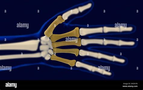 Hand Metacarpal Bones Anatomy For Medical Concept 3d Illustration Stock