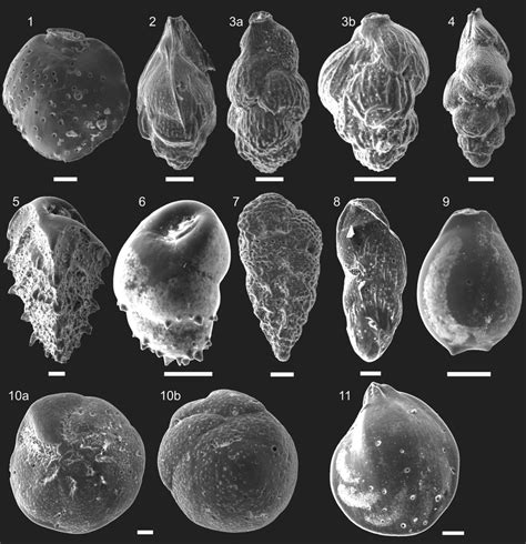 Sem Images In Secondary Electrons Of Deep Sea Benthic Foraminifera From