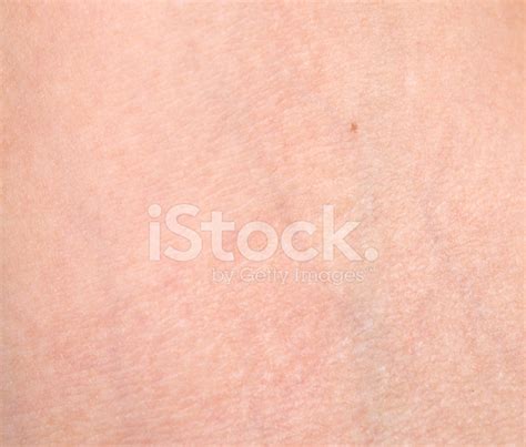 Allergic Rash Dermatitis Skin Stock Photo Royalty Free Freeimages