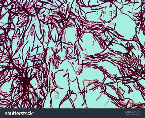 Bacterial Culture Genus Streptobacillus Under Microscope Foto Stock