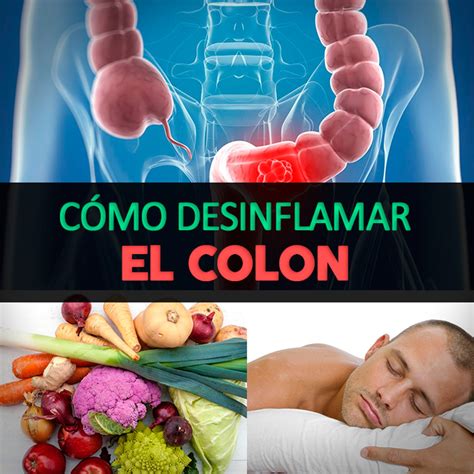 40 Most Popular Alimentos Para Colitis Ulcerosa Cronica Insectza