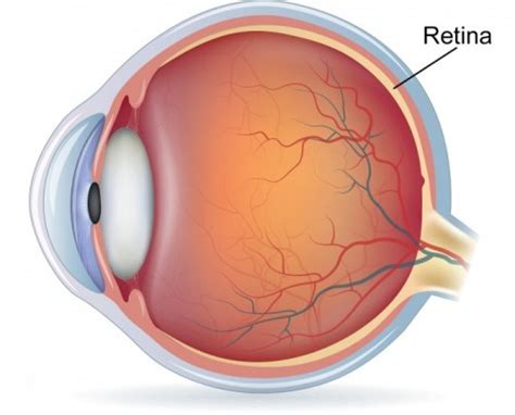 Retinal Detachment Treatment Orange County Retina Specialists