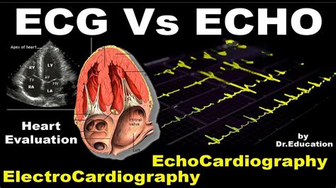 Rx Heart Epi 16 E Ecg Vs Echo Eng Electrocardiography Vs