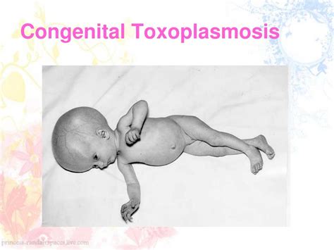 Ppt Toxoplasmosis Powerpoint Presentation Free Download Id4797160