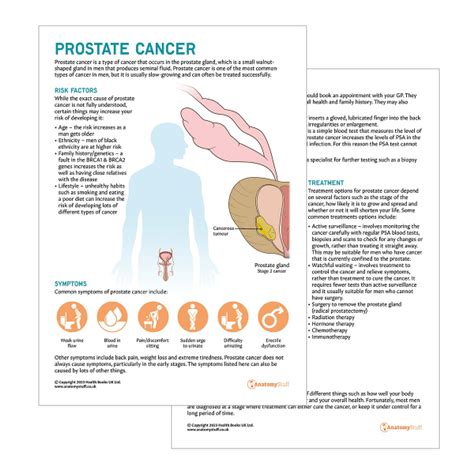 Prostate Cancer Patient Education Handout Anatomystuff