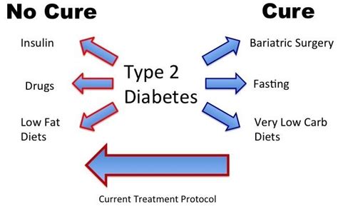 Treatments That Cure Type 2 Diabetes T2d5 The Fasting Method