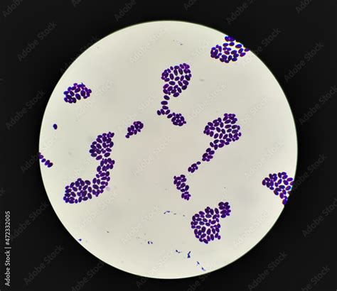 Culture Colonies Gram Stained Microscopic 100x Show Candida Spp Fungi