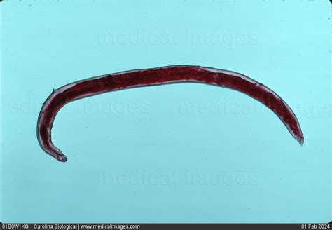 Stock Image Photomicrograph Of An Adult Female Hookworm Ancylostoma