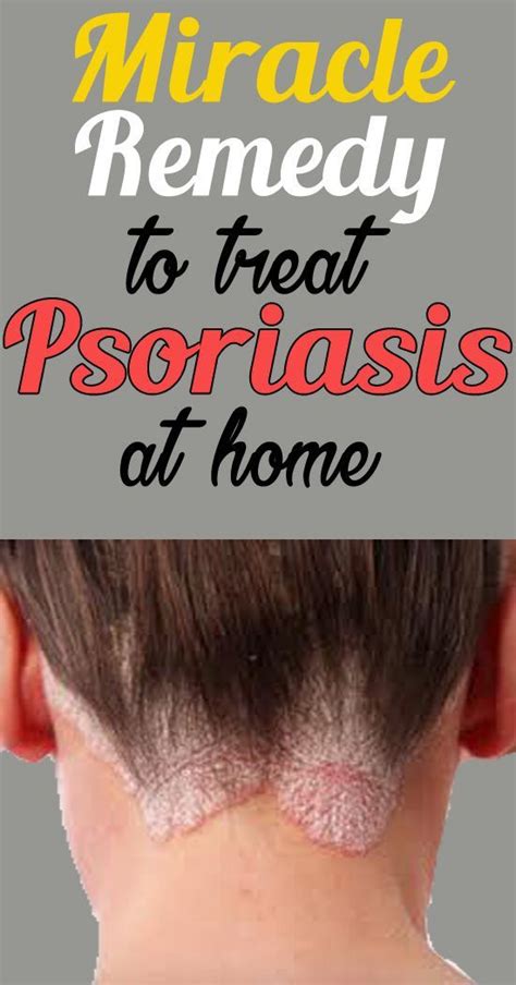 How To Use Oatmeal For Psoriasis You Must Take Utmost Care While