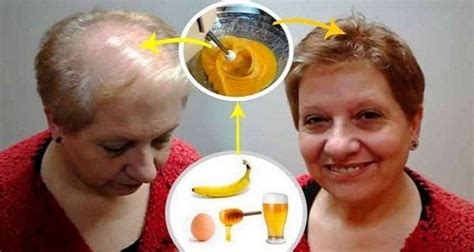 All Doctors Are Shocked By This Incredible Hair Growth Recipe Health