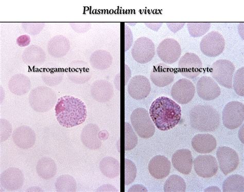 Public Domain Picture These Thin Film Giemsa Stained Micrographs