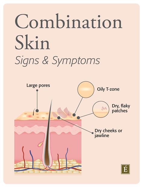 Combination Skin What It Is And How To Manage It Eminence Organic Skin