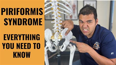Piriformis Syndrome Everything You Absolutely Need To Know To Get Better Youtube