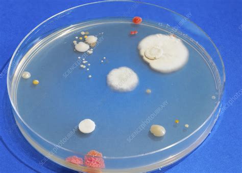 Bacterial Colonies In Petri Dish Stock Image F0273030 Science