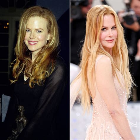 Did Nicole Kidman Have Plastic Surgery See Transformation Life And Style