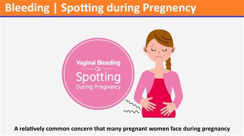 Spotting A Relatively Common Concern That Many Pregnant Women Face