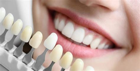 Teeth Bonding Vs Veneers Supreme Dental
