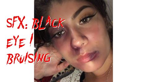 Sfx Makeup Bruisingblack Eye Youtube