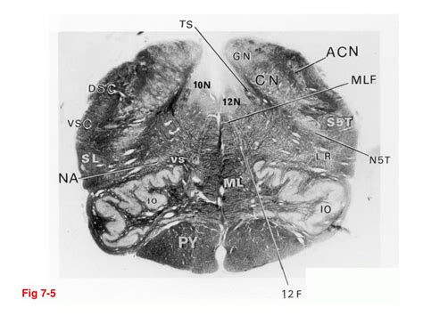 A lateral view (right side) of the brainstem relative to. PPT - Brain stem: Nuclei and tracts PowerPoint ...
