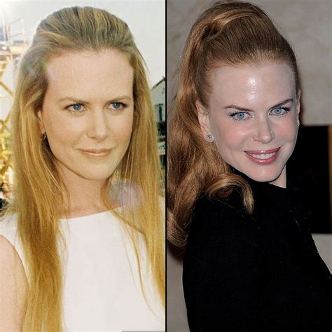 Nicole Kidman At 44 How Her Face Has Changed Us Weekly