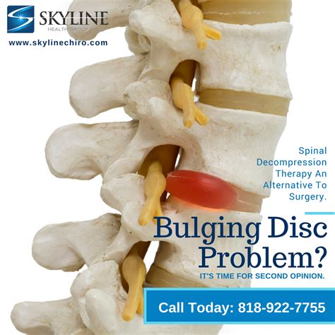 Bulging Disc Do You Suffer From A Bulging Disc Problem Its Time To