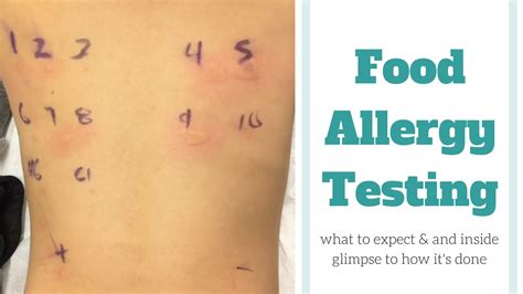 Usa's market leader in allergy tests and intolerance tests. Food Allergy Testing - YouTube