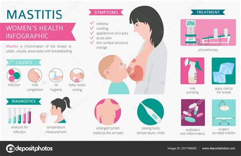 Mastitis Breastfeed Medical Infographic Diagnostics Symptoms Treatment