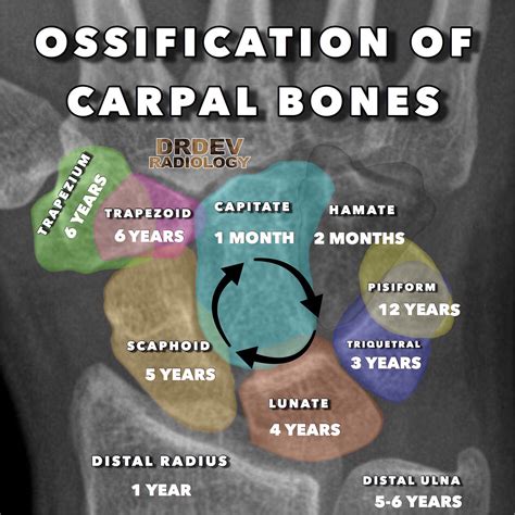 Ossification Of Carpal Bones Its Always Tricky Grepmed