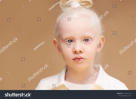 Portrait Albino Kid Girl White Skin Stock Photo 1739751413 Shutterstock