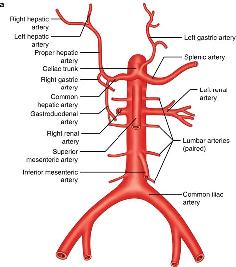 Small foramen in basilar artery wellcome l0037448.jpg 2,394 × 3,348; The IR Road Map: Vascular Anatomy Overview | SpringerLink