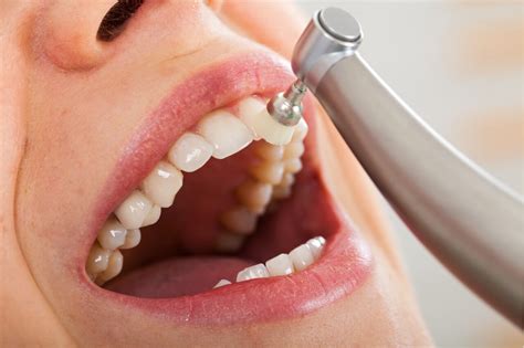 Maybe you would like to learn more about one of these? Dental hygiene: How long does a dental cleaning take?