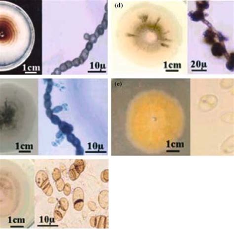 Colony And Morphology Of Aureobasidium Isolates A Colony And Hypha
