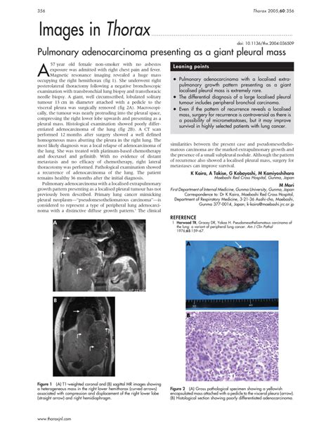 Pdf Pulmonary Adenocarcinoma Presenting As A Giant Pleural Mass