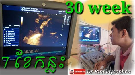 ពិនិត្យឣេកូផ្ទៃពោះ 7ខែ កន្លះ Pregnancy Ultrasound 30 Week By Drbun