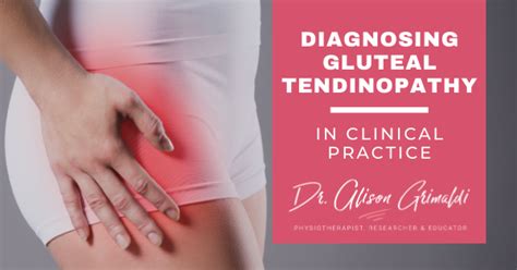 Diagnosing Gluteal Tendinopathy In Clinical Practice Dr Alison Grimaldi