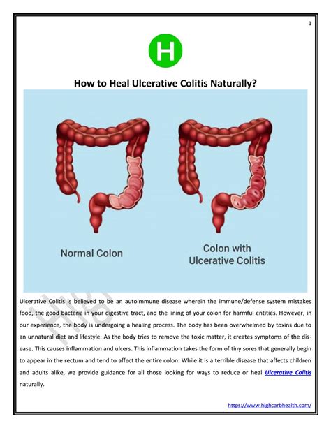 How To Heal Ulcerative Colitis Naturally By Highcarbhealth Issuu