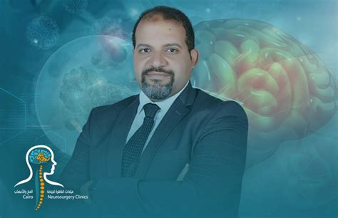 افضل دكتور جراحة مخ واعصاب في مصر الدكتور احمد عبد الرحمن