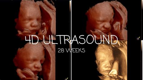 We Got A 4d Ultrasound 28 Weeks Youtube