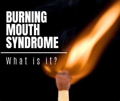 Burning Mouth Syndrom What Is It