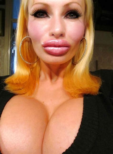 Thick Fake Plastic Bimbo Lips 64 Pics XHamster